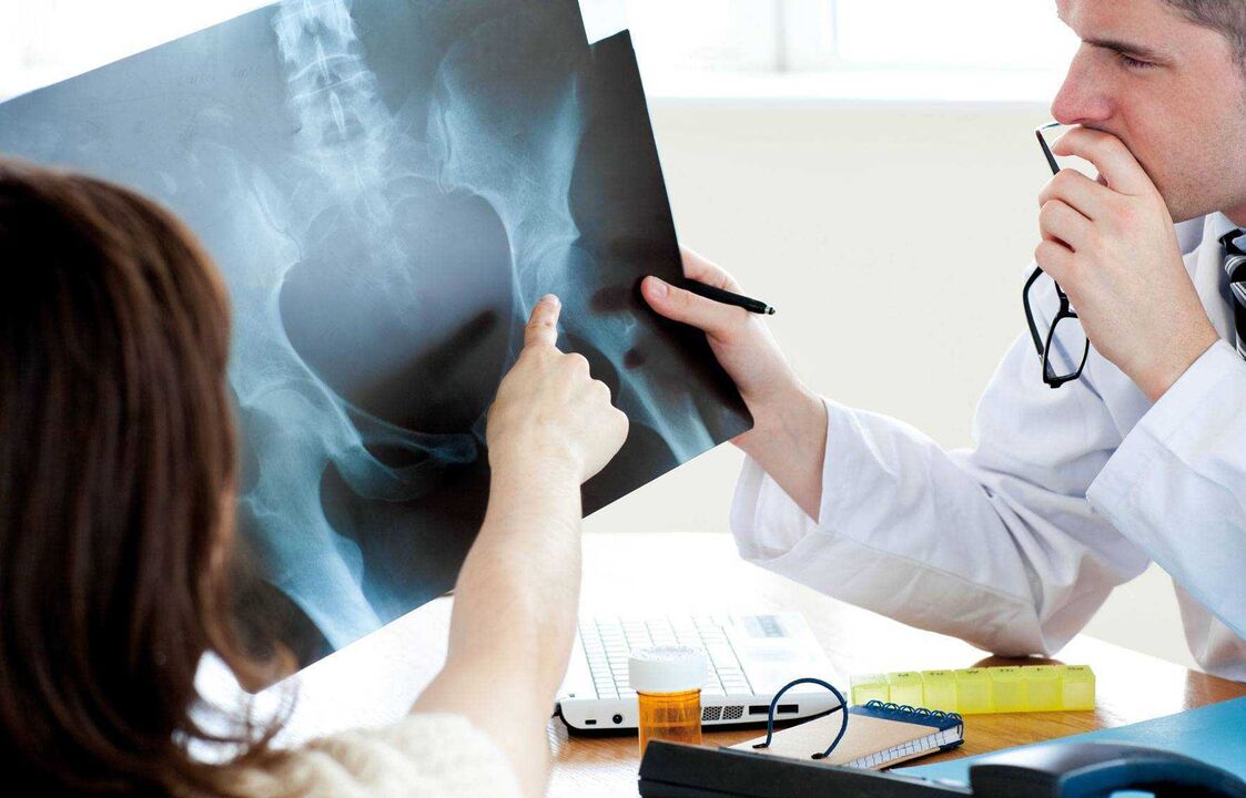 doktor memeriksa x-ray untuk arthrosis pinggul